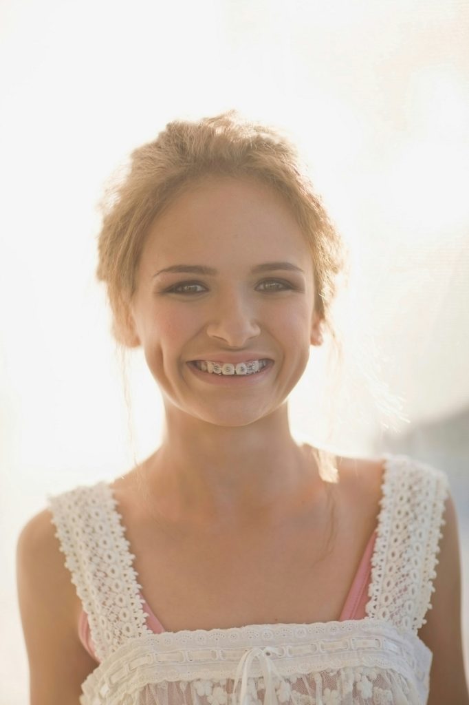 Teenage girl smiling to reveal braces